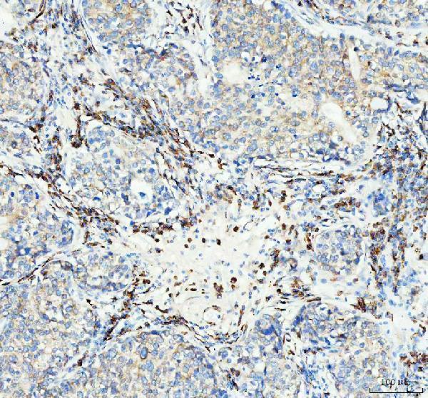m01006 tacr1 primary antibodies ihc testing 2