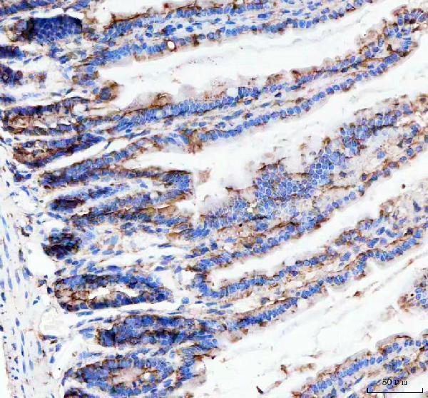 m01006 tacr1 primary antibodies ihc testing 3