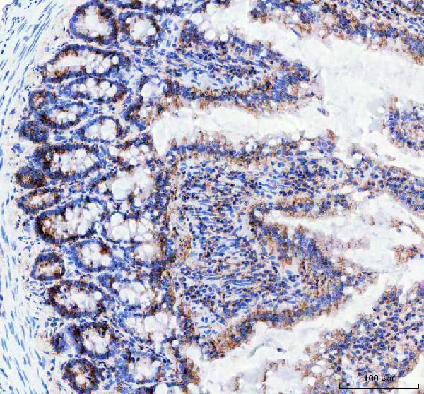 m01006 tacr1 primary antibodies ihc testing 4
