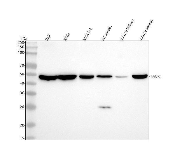 m01006 tacr1 primary antibodies wb testing 1