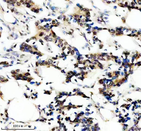 IHC analysis of CBFB using anti-CBFB antibody (M01007-1)