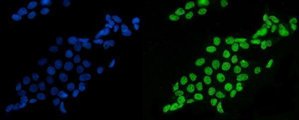 m01009 1 sf1 primary antibodies if testing 7
