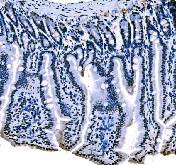 m01009 1 sf1 primary antibodies ihc testing 11_1