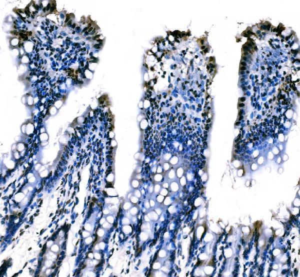 m01009 1 sf1 primary antibodies ihc testing 12