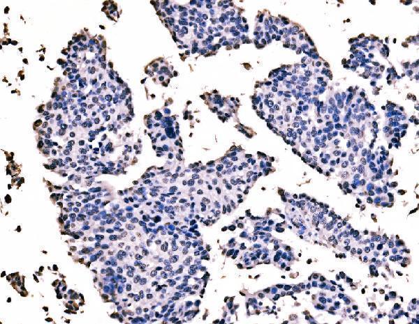 IHC analysis of splicing factor 1 using anti-splicing factor 1 antibody (M01009-1)