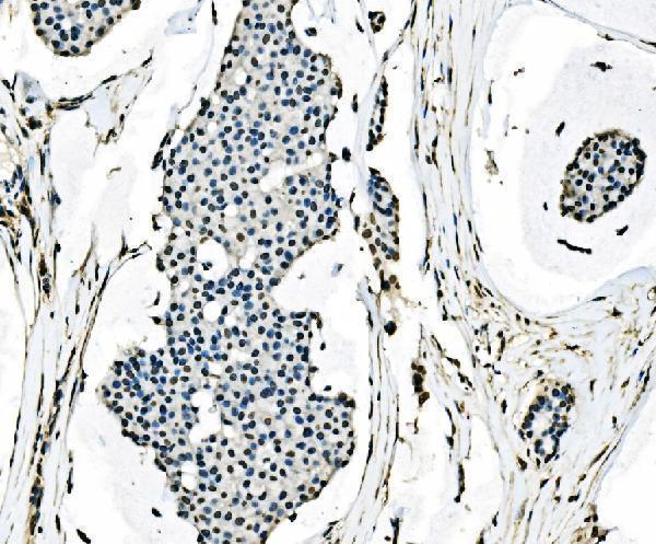  IHC analysis of splicing factor 1 using anti-splicing factor 1 antibody (M01009-1)