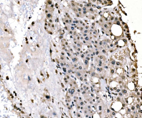 m01009 1 sf1 primary antibodies ihc testing 4