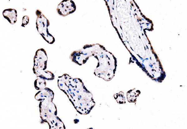 m01009 1 sf1 primary antibodies ihc testing 5