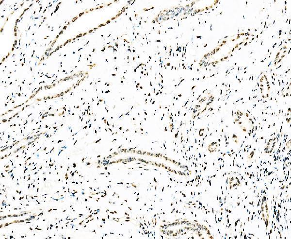 m01009 1 sf1 primary antibodies ihc testing 6
