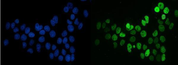 m01009 2 sf1 primary antibodies if testing 7