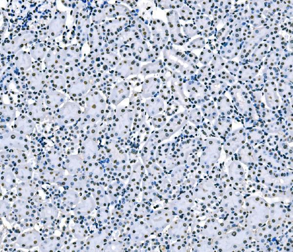 m01009 2 sf1 primary antibodies ihc testing 12