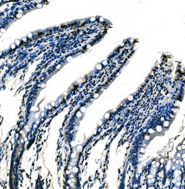 m01009 2 sf1 primary antibodies ihc testing 13