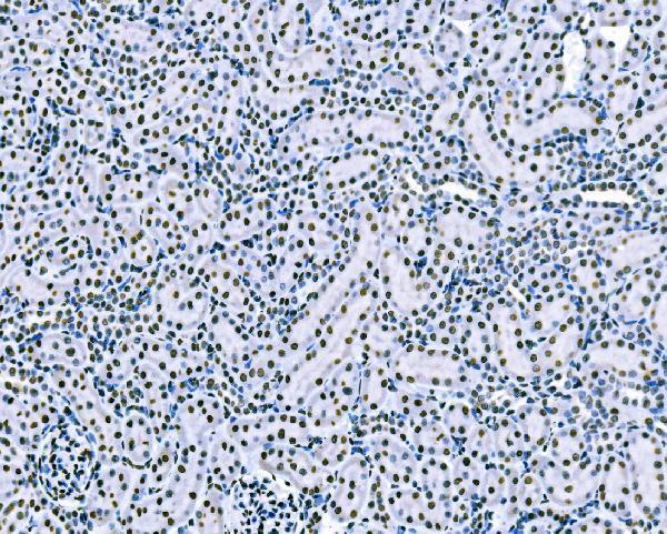 m01009 2 sf1 primary antibodies ihc testing 14