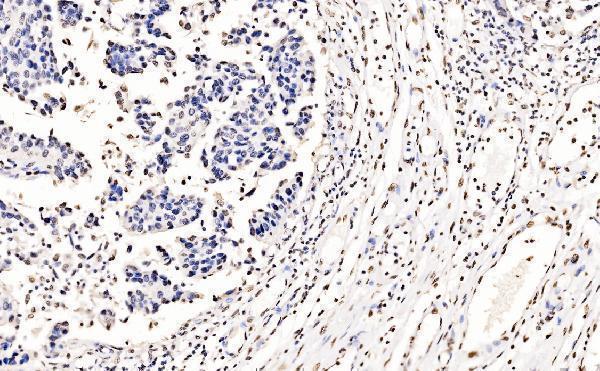  IHC analysis of splicing factor 1 using anti-splicing factor 1 antibody (M01009-2)