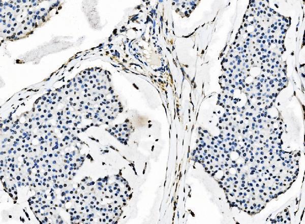  IHC analysis of splicing factor 1 using anti-splicing factor 1 antibody (M01009-2)