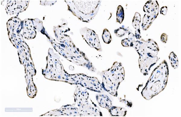 m01009 2 sf1 primary antibodies ihc testing 5