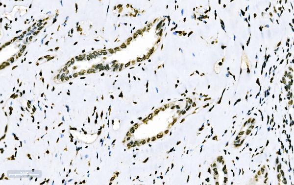 m01009 2 sf1 primary antibodies ihc testing 6