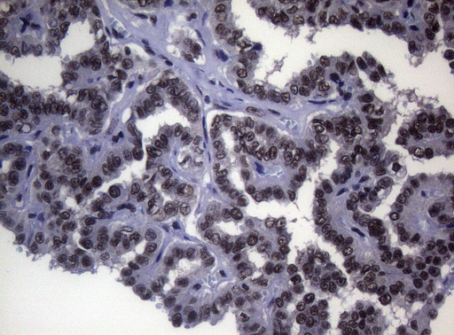 m01009 anti splicing factor 1 sf1 mouse monoclonal antibody clone id oti7h9 ihc testing 3