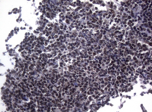 m01009 anti splicing factor 1 sf1 mouse monoclonal antibody clone id oti7h9 ihc testing 5