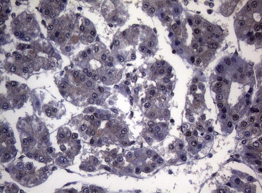 m01009 anti splicing factor 1 sf1 mouse monoclonal antibody clone id oti7h9 ihc testing 6