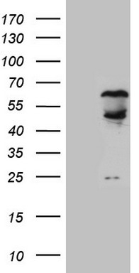 m01009 anti splicing factor 1 sf1 mouse monoclonal antibody clone id oti7h9 wb testing 1