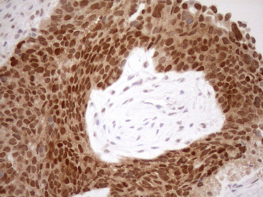 m01012 1 anti mgmt mouse monoclonal antibody clone id oti2f10 ihc testing 10