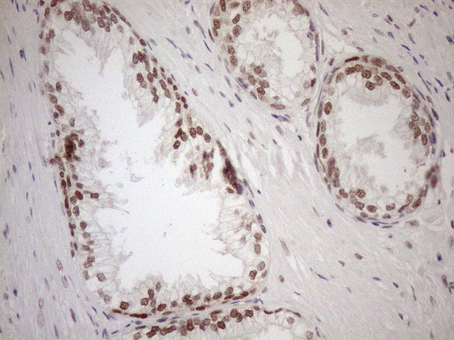 m01012 1 anti mgmt mouse monoclonal antibody clone id oti2f10 ihc testing 11