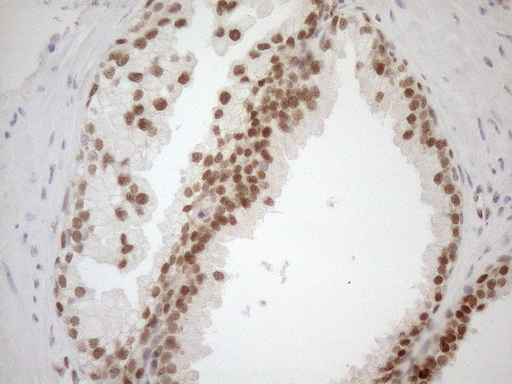 m01012 1 anti mgmt mouse monoclonal antibody clone id oti2f10 ihc testing 12