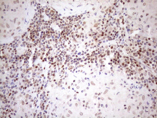 m01012 1 anti mgmt mouse monoclonal antibody clone id oti2f10 ihc testing 13