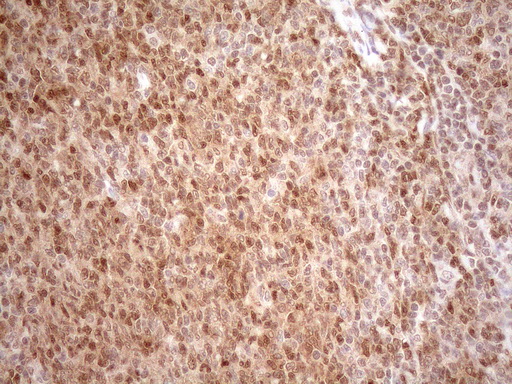 m01012 1 anti mgmt mouse monoclonal antibody clone id oti2f10 ihc testing 14