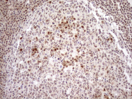 m01012 1 anti mgmt mouse monoclonal antibody clone id oti2f10 ihc testing 15