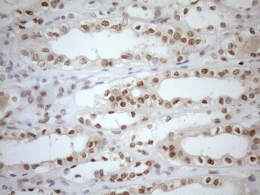m01012 1 anti mgmt mouse monoclonal antibody clone id oti2f10 ihc testing 17