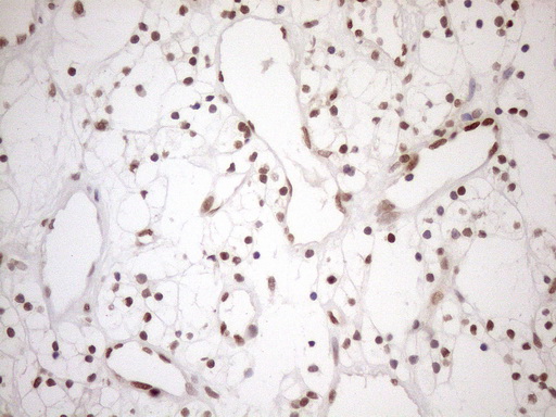 m01012 1 anti mgmt mouse monoclonal antibody clone id oti2f10 ihc testing 18