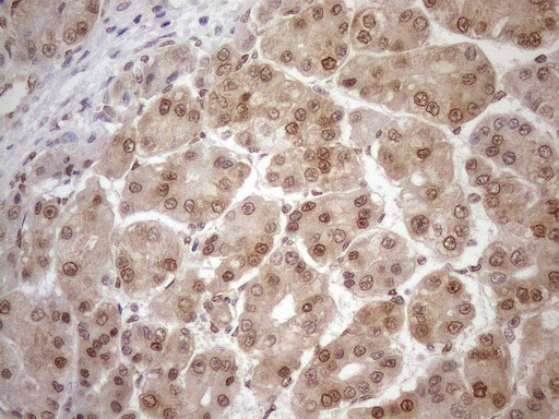 m01012 1 anti mgmt mouse monoclonal antibody clone id oti2f10 ihc testing 19
