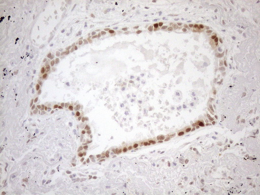 m01012 1 anti mgmt mouse monoclonal antibody clone id oti2f10 ihc testing 3