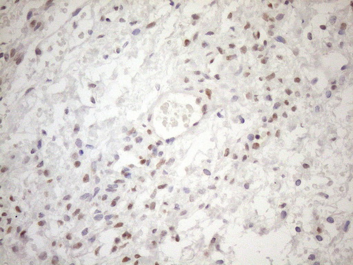 m01012 1 anti mgmt mouse monoclonal antibody clone id oti2f10 ihc testing 4