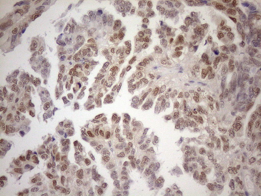 m01012 1 anti mgmt mouse monoclonal antibody clone id oti2f10 ihc testing 5