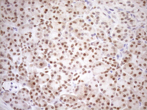 m01012 1 anti mgmt mouse monoclonal antibody clone id oti2f10 ihc testing 6