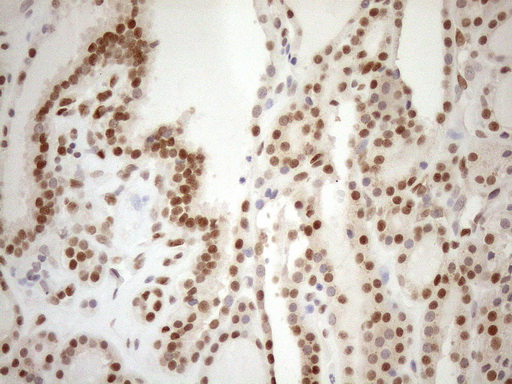 m01012 1 anti mgmt mouse monoclonal antibody clone id oti2f10 ihc testing 7