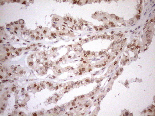 m01012 1 anti mgmt mouse monoclonal antibody clone id oti2f10 ihc testing 8