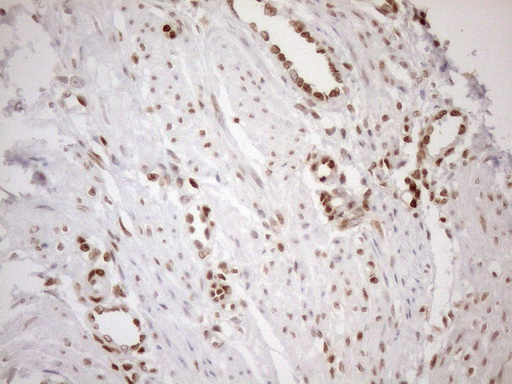 m01012 1 anti mgmt mouse monoclonal antibody clone id oti2f10 ihc testing 9