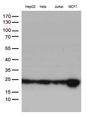 m01012 1 anti mgmt mouse monoclonal antibody clone id oti2f10 wb testing 2