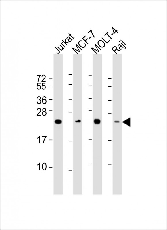 All lanes : Anti-MGMT Antibody at1:1000-1:2000 dilutionLane 1: Jurkat whole cell lysateLane 2: MCF-7 whole cell lysateLane 3: MOLT-4 whole cell lysateLane 4: Raji whole cell lysateLysates/proteins at 20 μg per lane