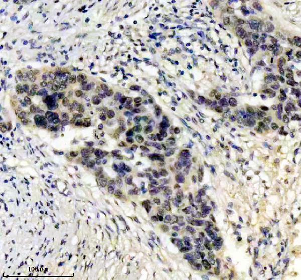 m01012 mgmt primary antibodies ihc testing 3