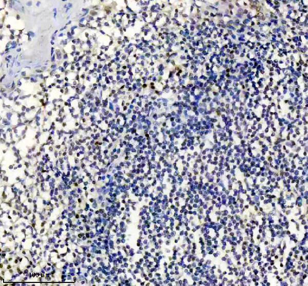 m01012 mgmt primary antibodies ihc testing 4