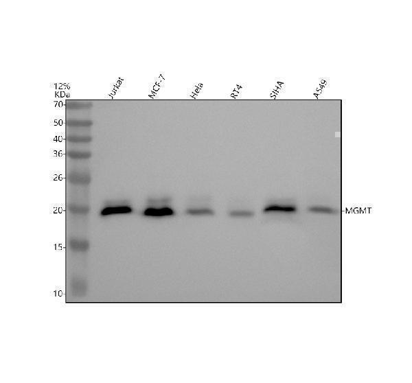 Western blot analysis of MGMT using anti-MGMT antibody (M01012)