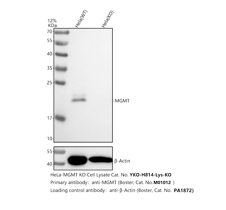 m01012 mgmt primary antibodies wb testing 2