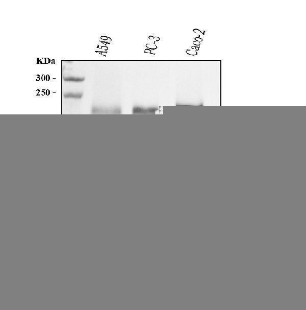  Western blot analysis of ITGB4 using anti-ITGB4 antibody (M01015-2)