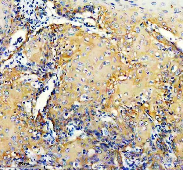 IHC analysis of Integrin Beta 4/ITGB4 using anti-Integrin Beta 4/ITGB4 antibody (M01015)