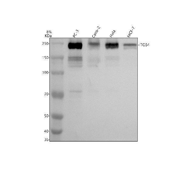 Western blot analysis of Integrin Beta 4/ITGB4 using anti-Integrin Beta 4/ITGB4 antibody (M01015)